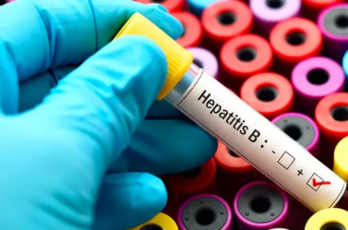 Waspada! Penyandang Hepatitis B di Indonesia Tertinggi di Asia Tenggara