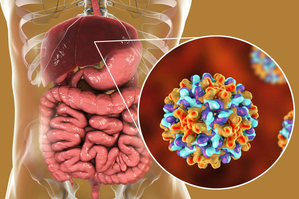 Waspada! Penyandang Hepatitis B Di Indonesia Tertinggi Di Asia Tenggara ...