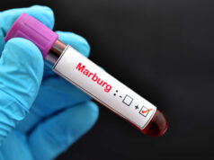 Virus Marburg Kini Jadi Ancaman Global, Indonesia Patut Waspada