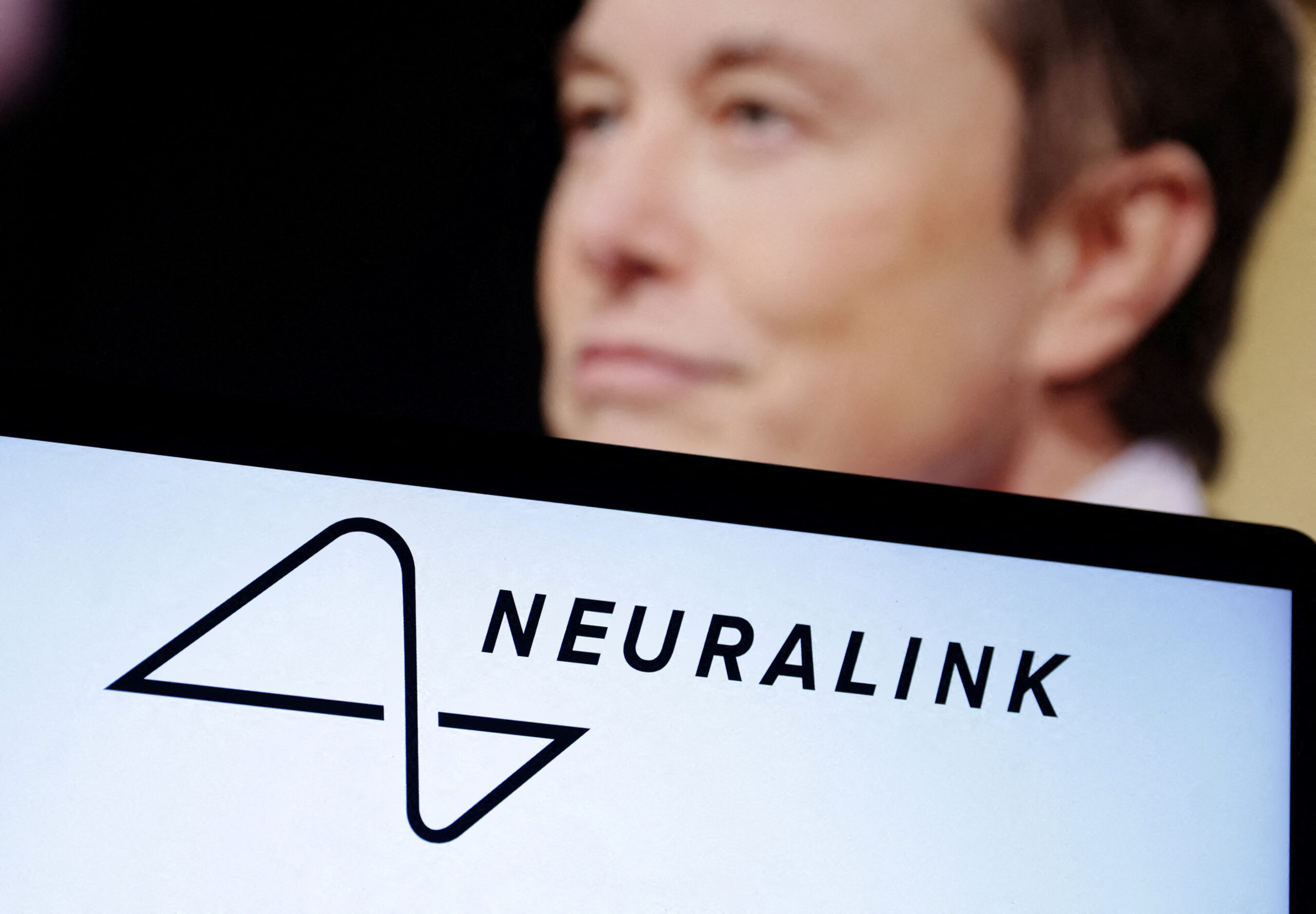 Perusahaan Elon Musk Dapat Izin Tanam Chip di Otak Manusia