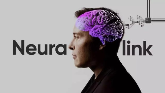 Perusahaan Elon Musk Dapat Izin Tanam Chip di Otak Manusia